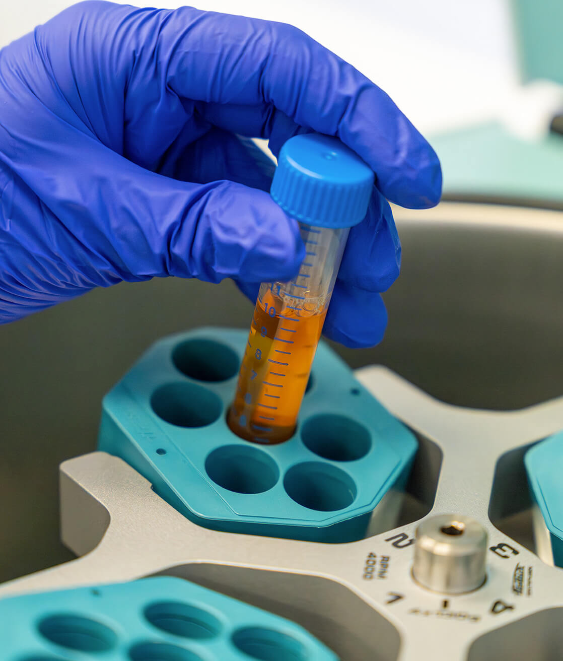 analisi anticorpi anti recettore dell'acetilcolina (AChR) - Laboratorio Euroimmun