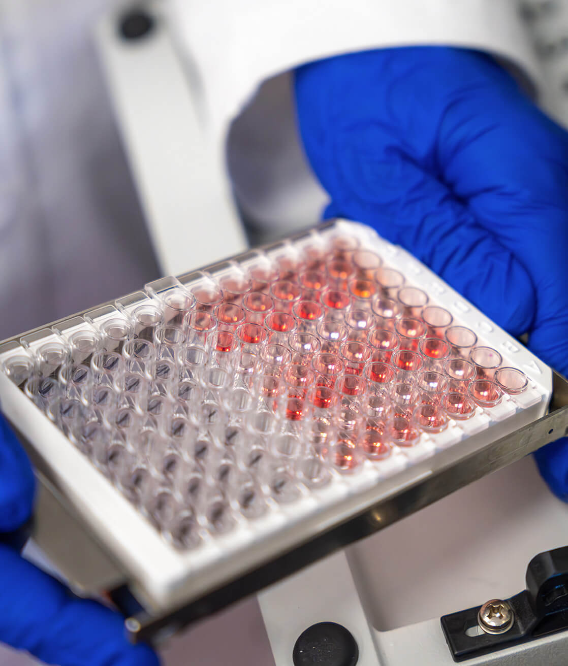 analisi anticorpi anti recettore dell'acetilcolina (AChR) - Laboratorio Euroimmun