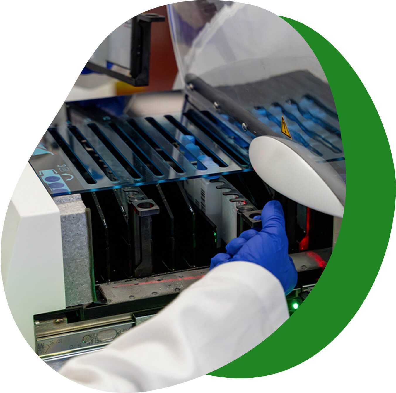 test sierologici per le allergie - Laboratorio Euroimmun