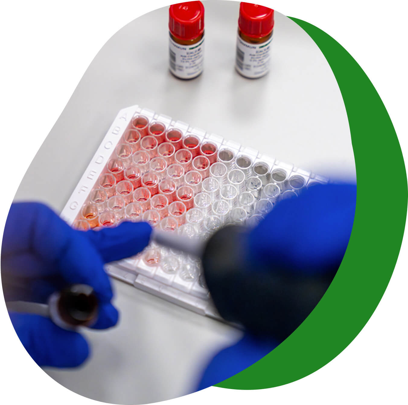 esami di endocrinologia - Laboratorio Euroimmun